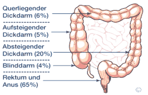 Abbildung und Schaubild Darm